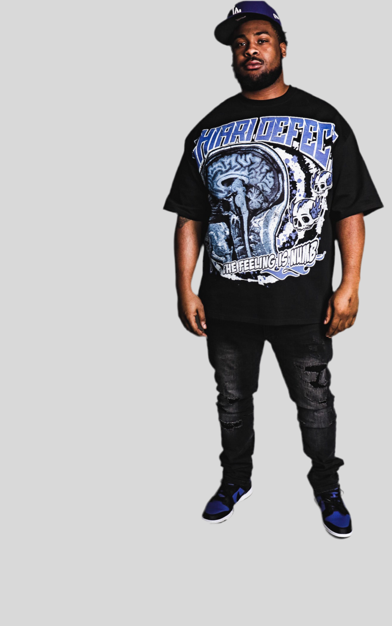 Chiari Defect “CT Scan” T-Shirt - Black