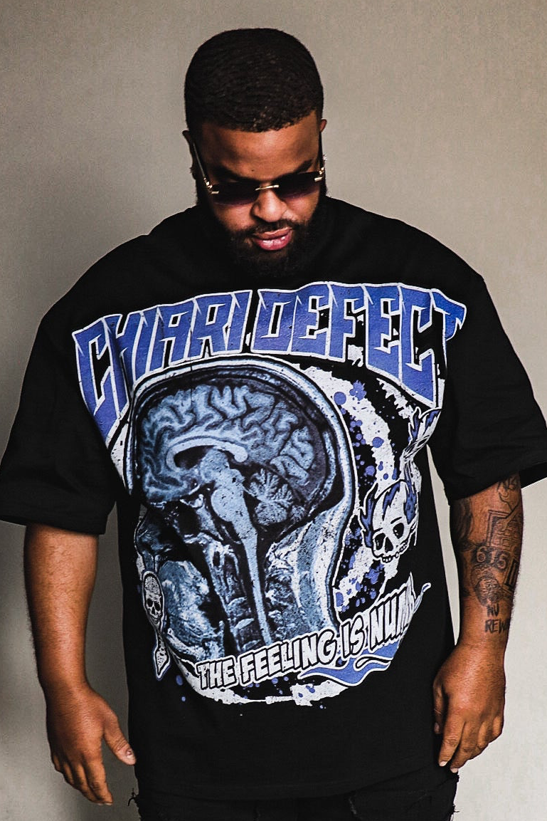 MRI Tee — Drop 01