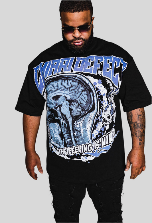 Chiari Defect “CT Scan” T-Shirt - Black