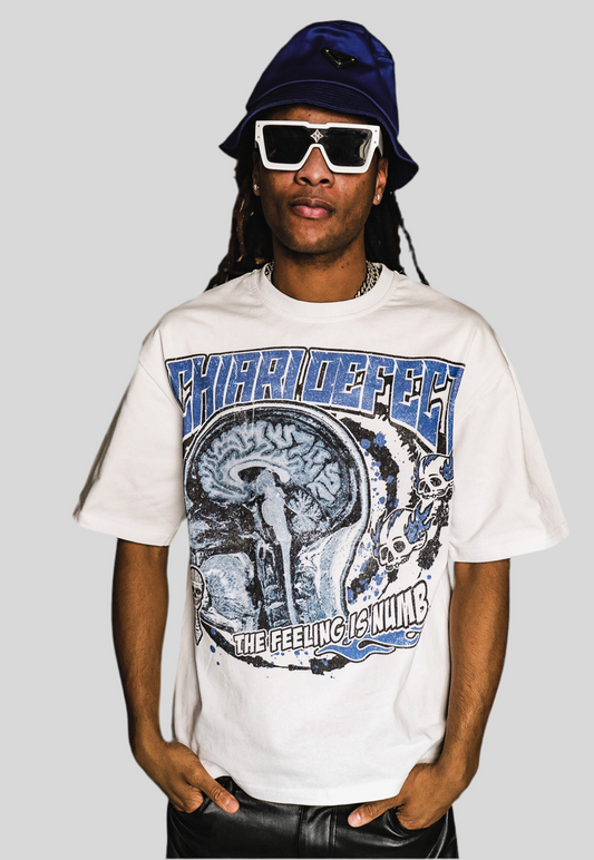 Chiari Defect “CT Scan” T-Shirt - White
